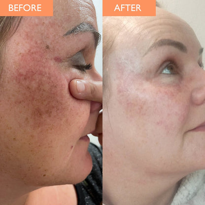 Viya Vitamin C Serum