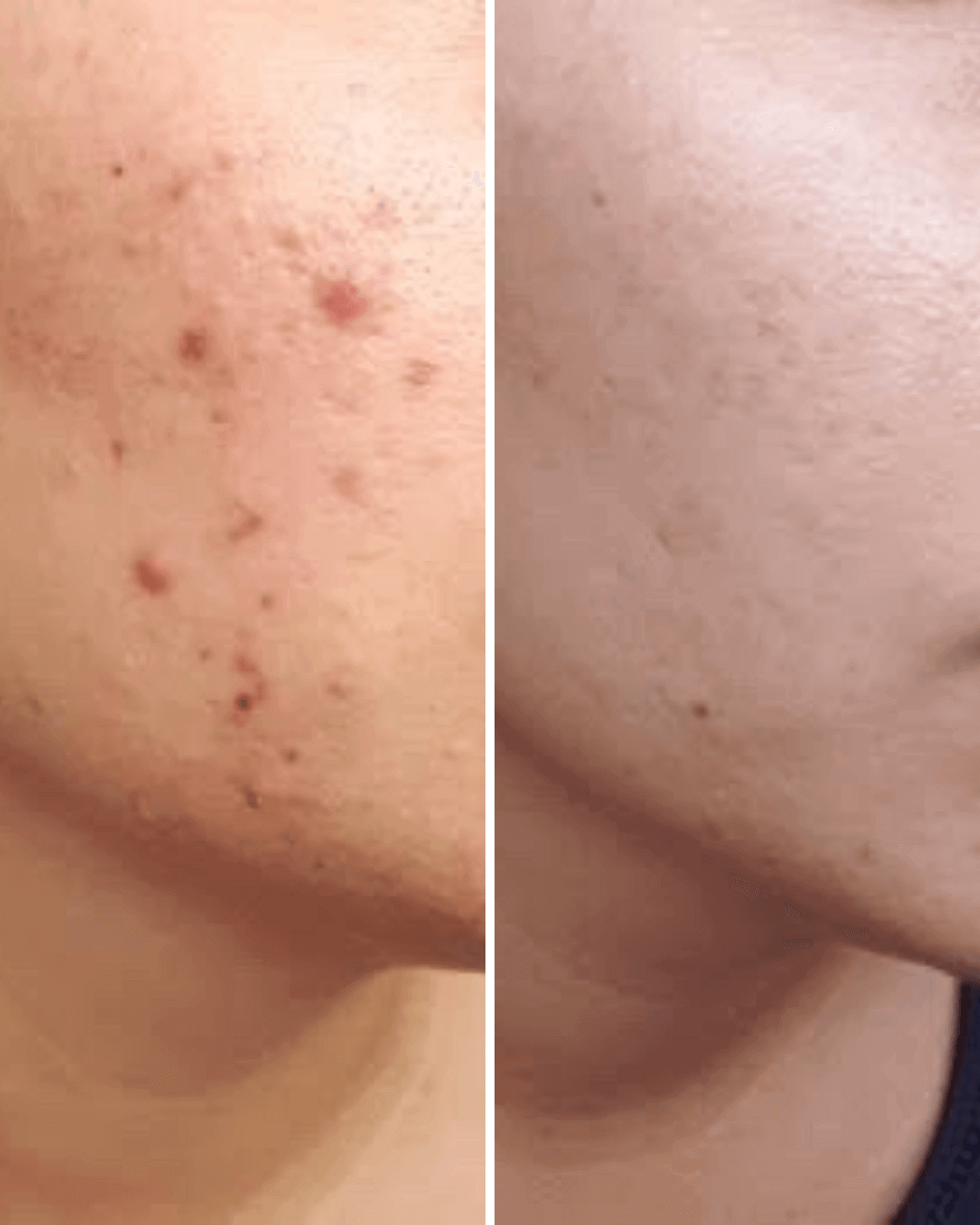 Viya Vitamin C Serum