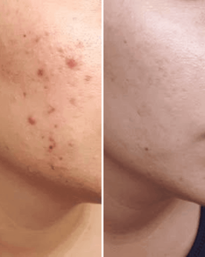 Viya Vitamin C Serum